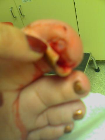toenail peek a boo ... gross, eh?  cool .. never looked inside there before